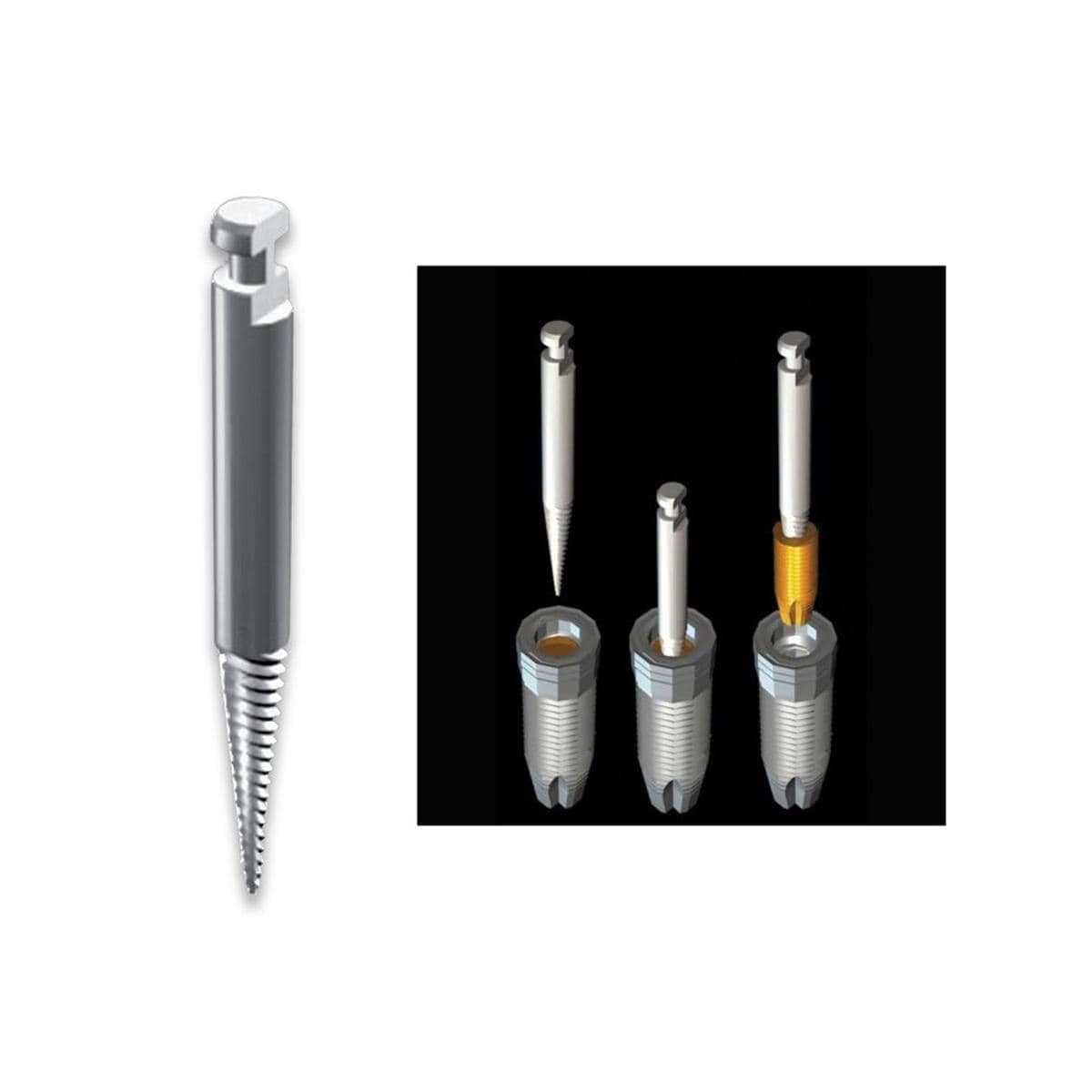 Extracteur d'implant ACTEON - pour vis tte de contre-angle