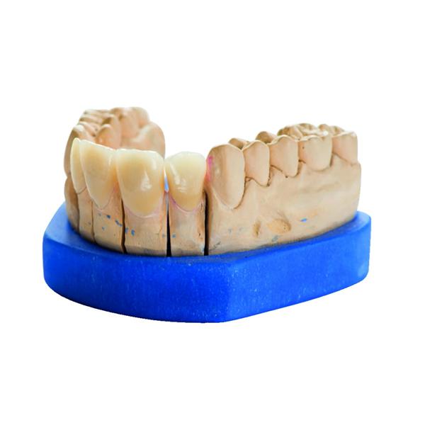Pltre Gibraltar-Die HENRY SCHEIN - Ivoire blanc - Le carton de 25 kg