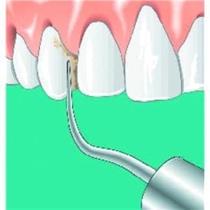 Insert SONICflex scaler n 8 KAVO