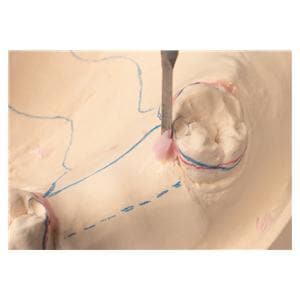 GEO Cire de dpouille ou blocage RENFERT - Rose opaque - Le bloc de 75 g