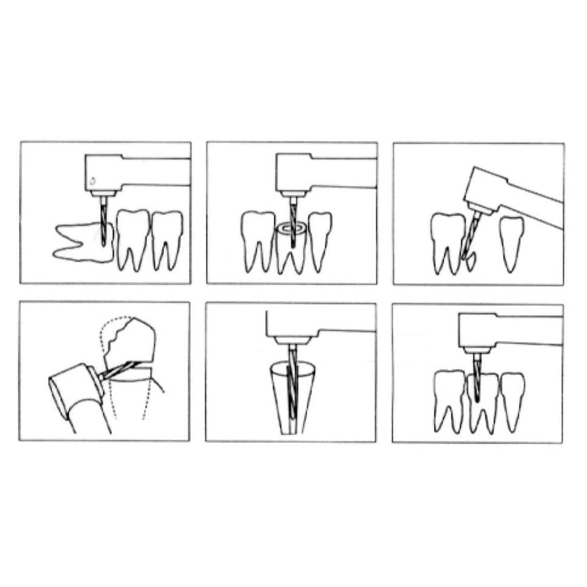 Fraise Zekrya DENTSPLY SIRONA - Cnique FG 23mm 151 008 - Bote de 5
