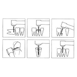 Fraise Zekrya DENTSPLY SIRONA - Extra longue FG 28mm 151 008 - Bote de 5