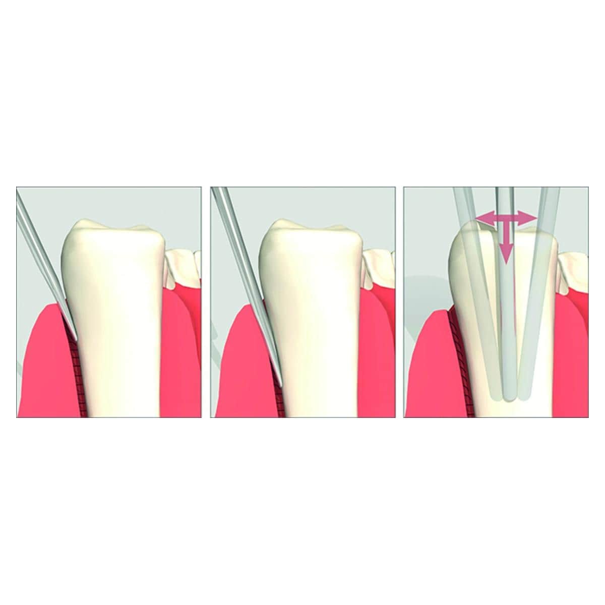 Luxator Periotome L2S