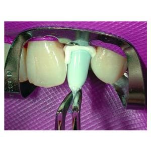 Paracore Automix COLTENE - Dentine - Coffret