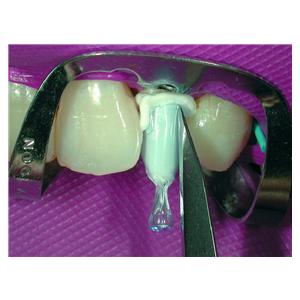 Paracore Automix COLTENE - Dentine - Coffret