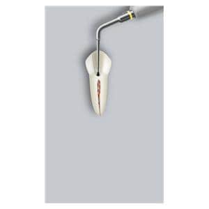 Insert Endo Success retraitement ETBD ACTEON SATELEC
