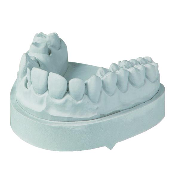 Pltre Moldastone CN KULZER - Champagne - Le carton de 18 kg