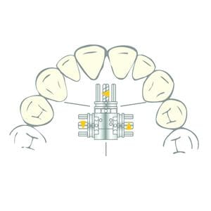Vector 730 SCHEU-DENTAL - Les 2 pices