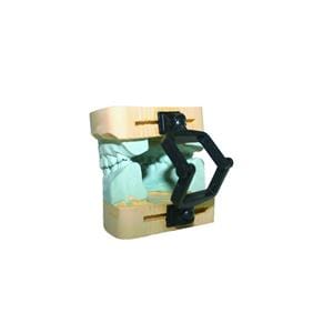 Occluseurs "TYPE VERTEX" - Le sachet de 100 slots - Blancs