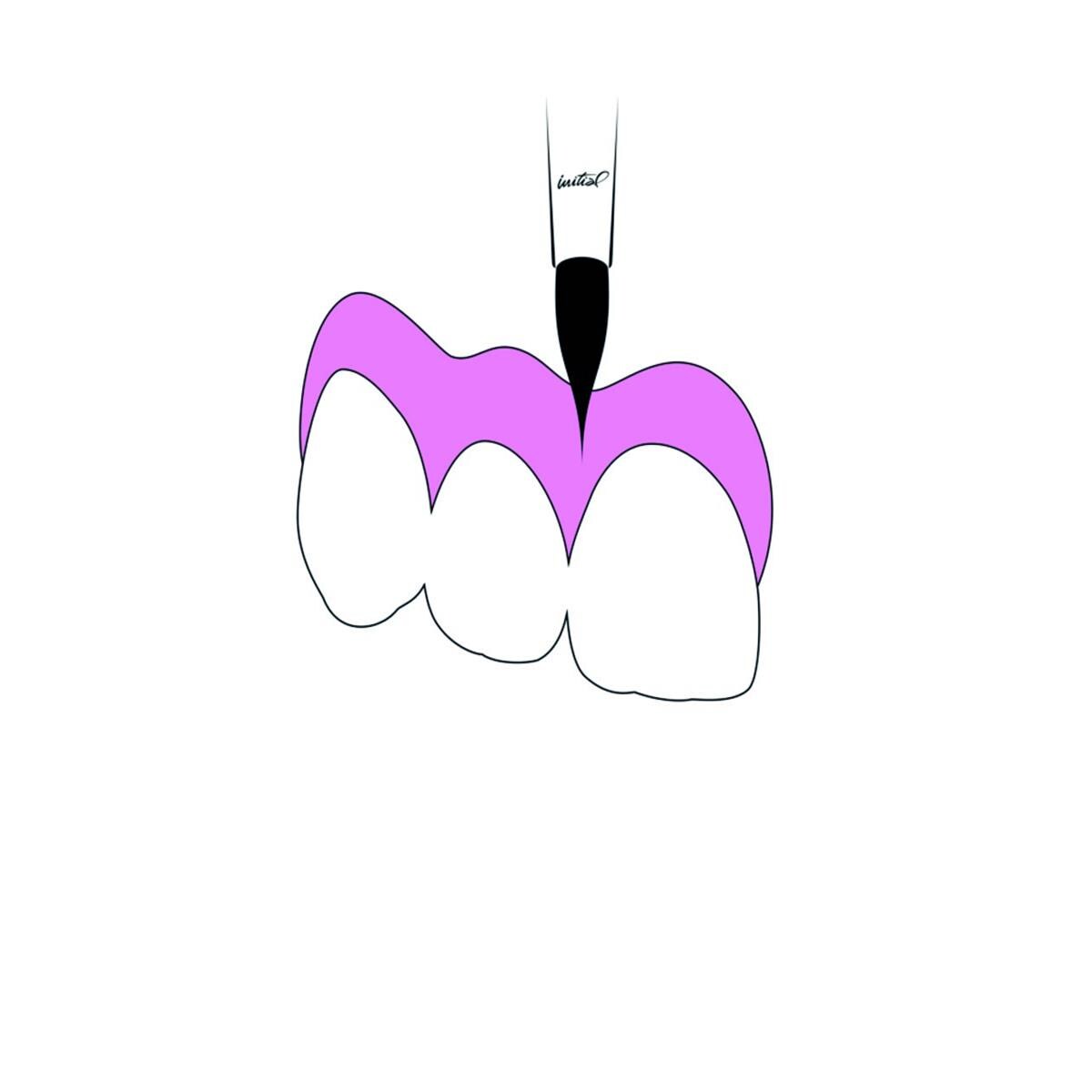 Initial IQ Lustre paste NF GC - Gum Shade Set