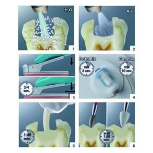 Ketac Universal Aplicap 3M - A3,5 - Bote de 50