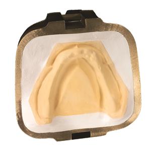 Pltre Sheraalabaster SHERA - Le carton de 20 kg