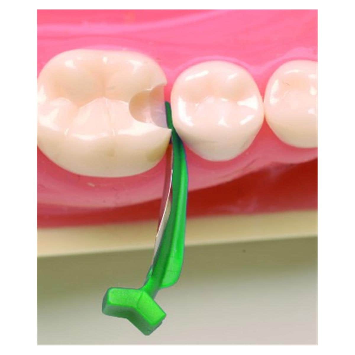 Fendermate DIRECTA - Assortiment