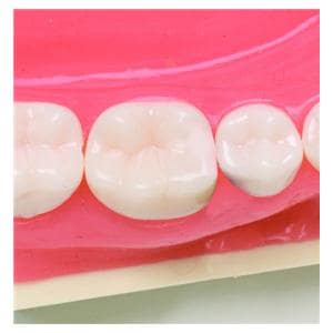 Fendermate DIRECTA - Assortiment