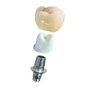 Tibase + vis DENTSPLY SIRONA - BO 3.4 L