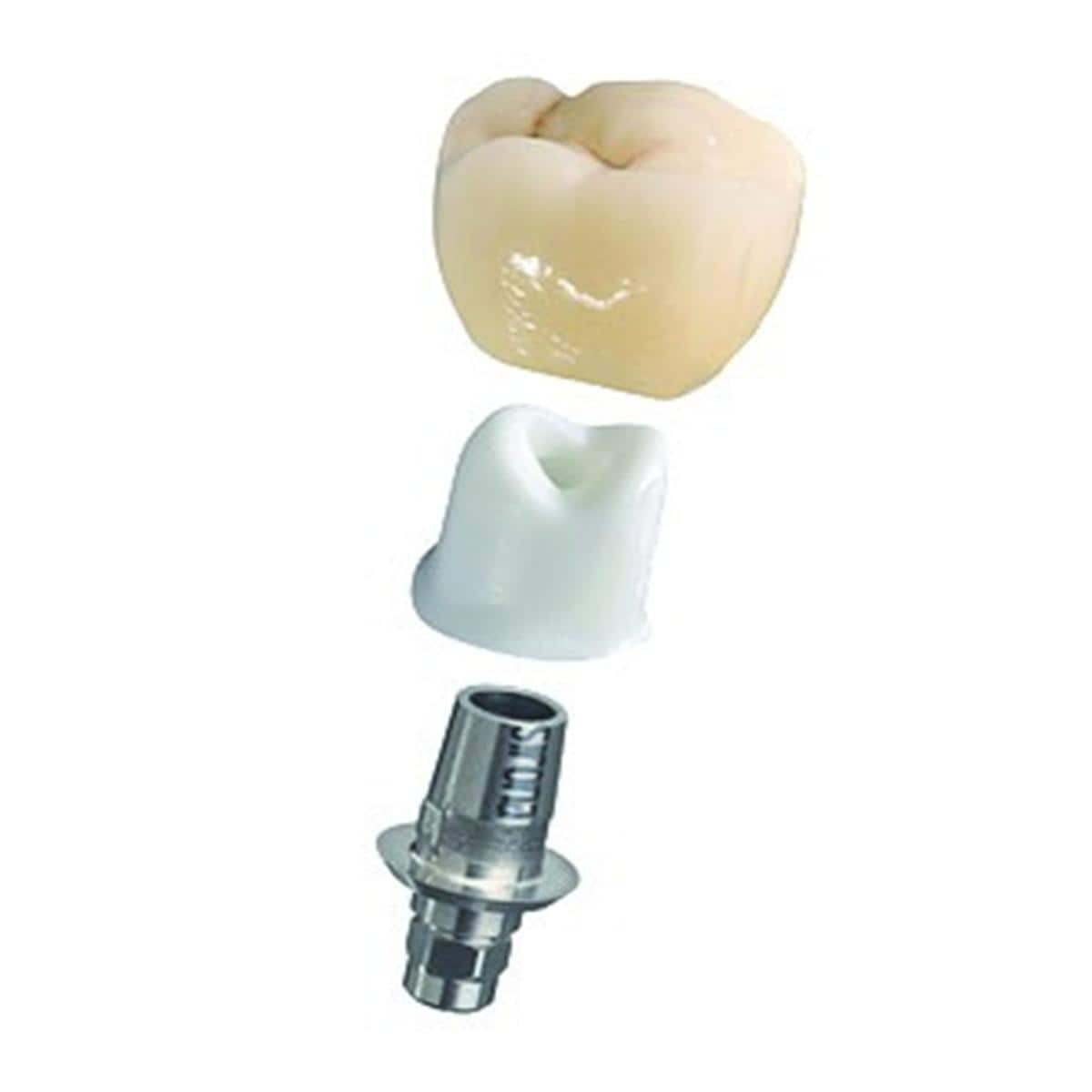 Tibase + vis DENTSPLY SIRONA - B C 5.0