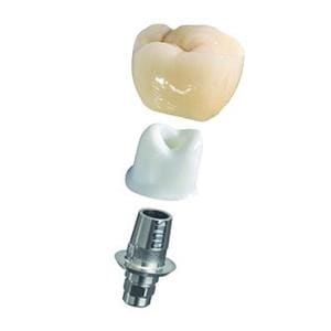 Tibase + vis DENTSPLY SIRONA - B C 5.0