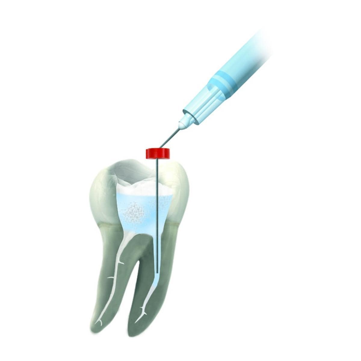 Reciproc DENTSPLY SIRONA - 21mm - n 25 - Blister de 6