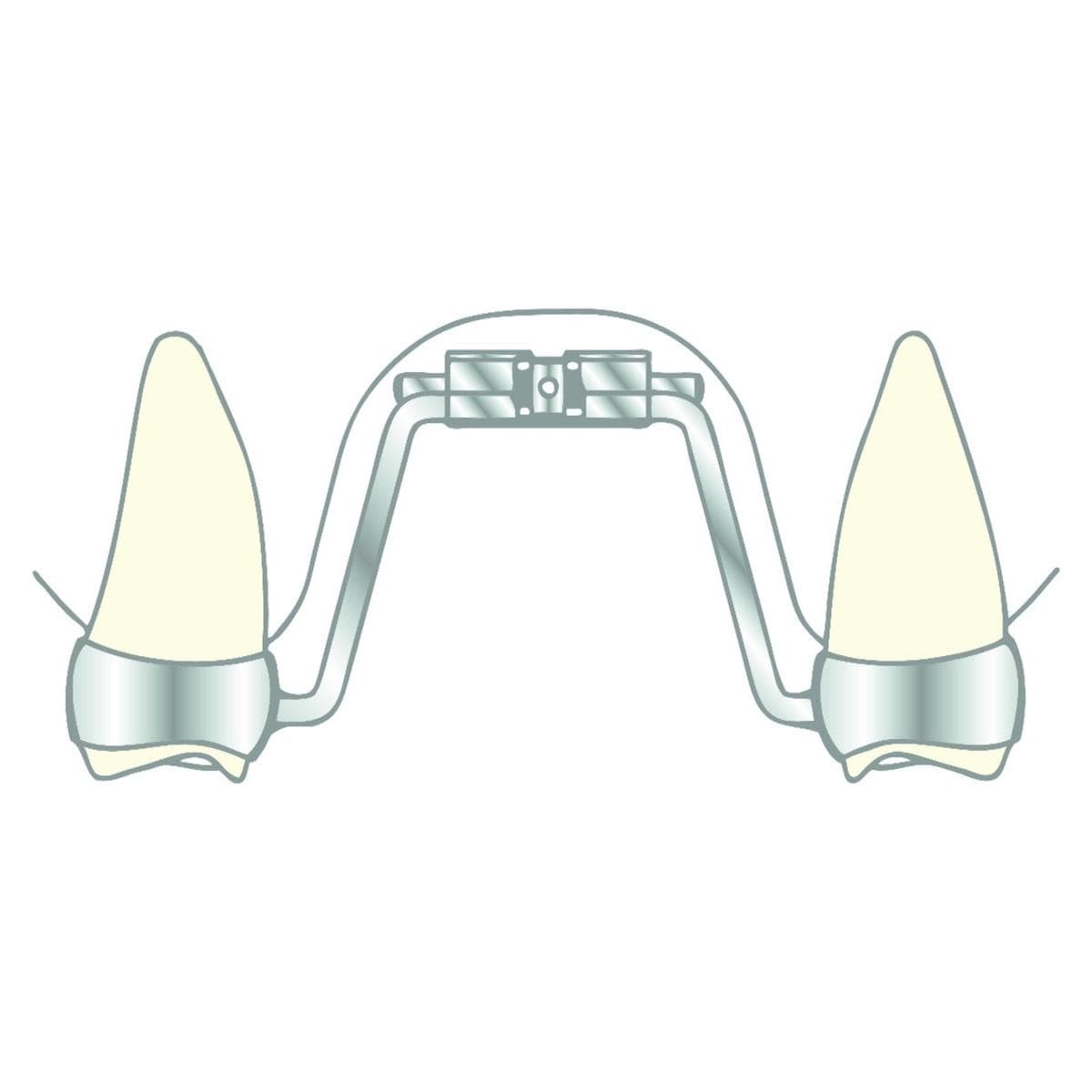 Vector 600 SCHEU-DENTAL - L'unit