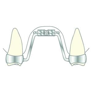 Vector 600 SCHEU-DENTAL - L'unit