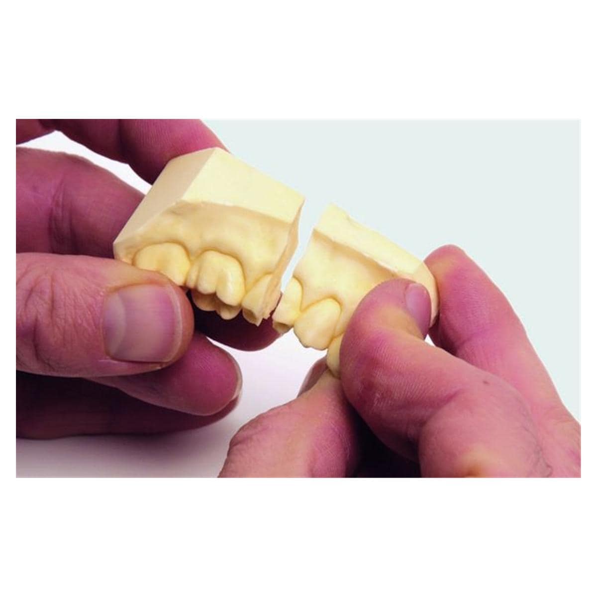 Colle instantane RENFERT - La bote de 6 x 5 g