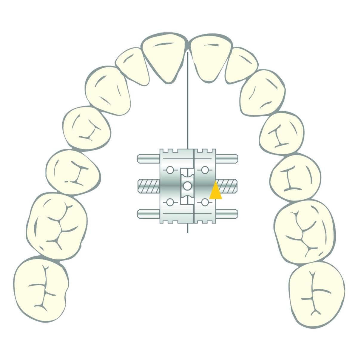 Vector 190 SCHEU-DENTAL - La bote de 10