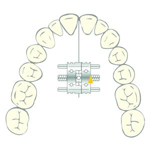 Vector 190 SCHEU-DENTAL - La bote de 10