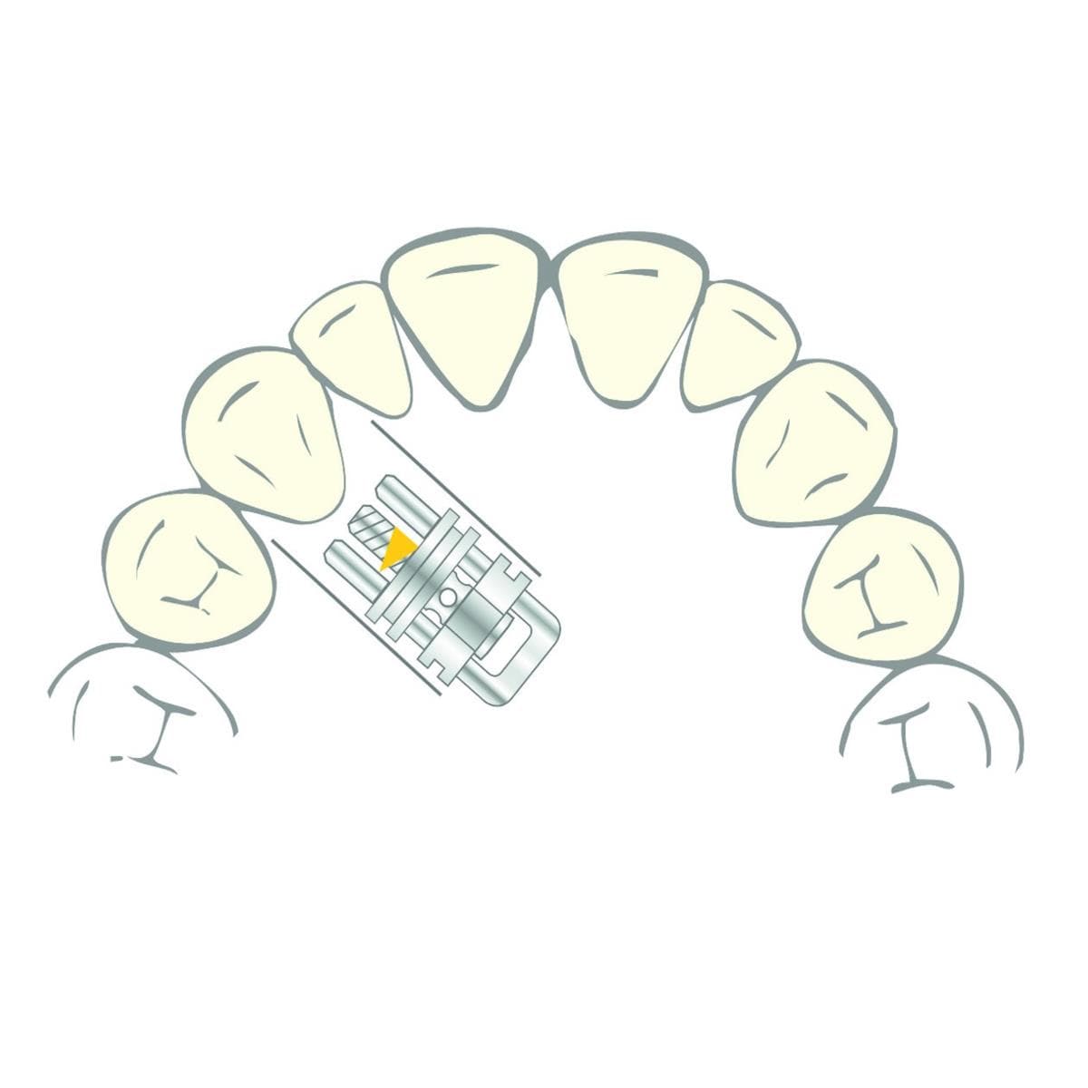 Vector 400 SCHEU-DENTAL - La bote de 10