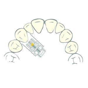 Vector 400 SCHEU-DENTAL - La bote de 10