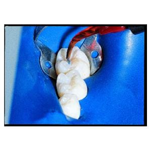 UltraSeal XT plus recharge teinte Opaque White 4 seringues