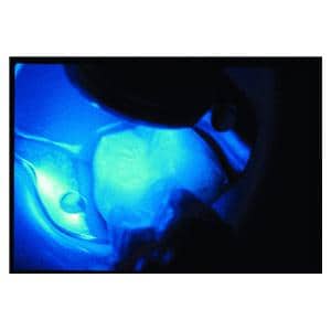 UltraSeal XT plus recharge teinte Opaque White 4 seringues