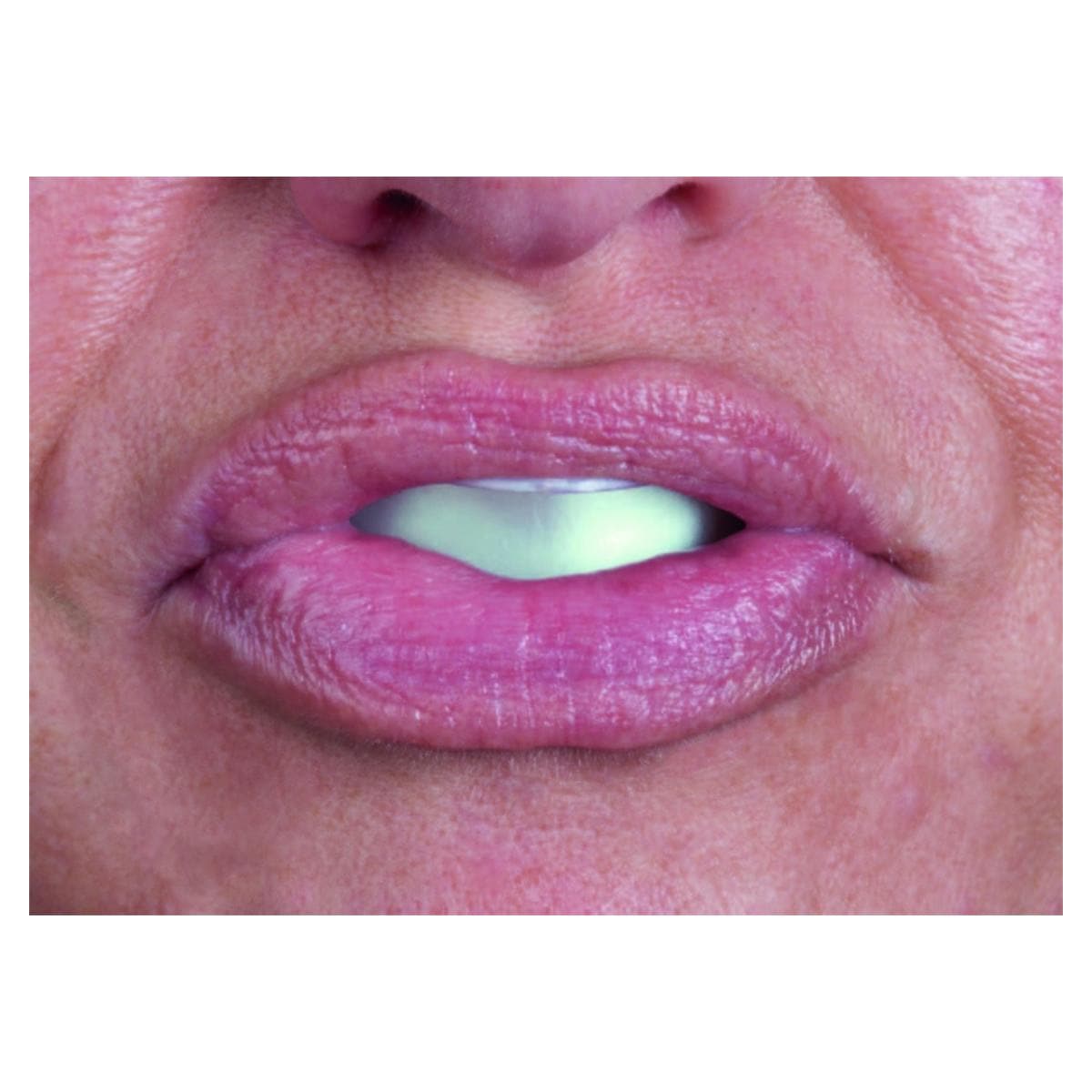 Opalescence GO 6% - Kit patient got menthe