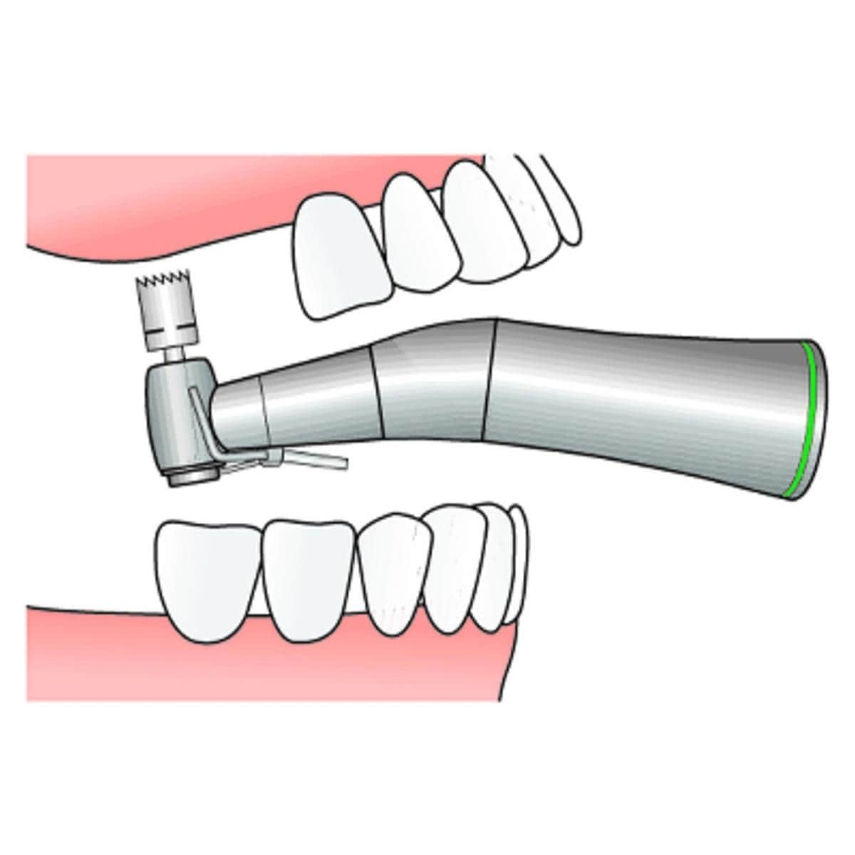 Trpan postrieur Dr Smiler ACE - 6 mm