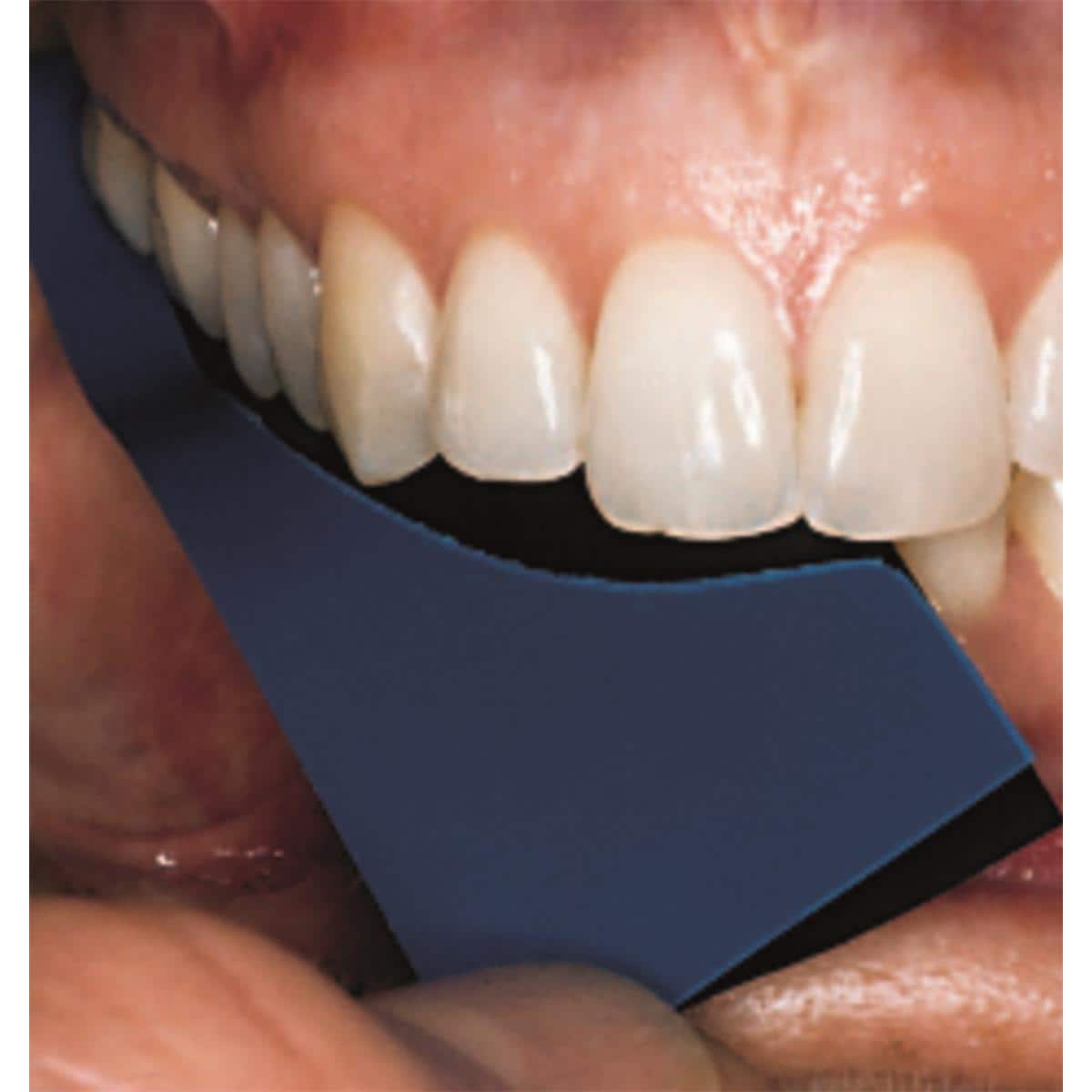 TrollFoil bleu, 100 pcs Directa Dental