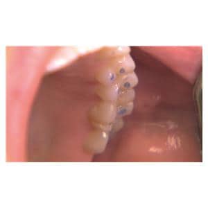 TrollFoil bleu, 100 pcs Directa Dental