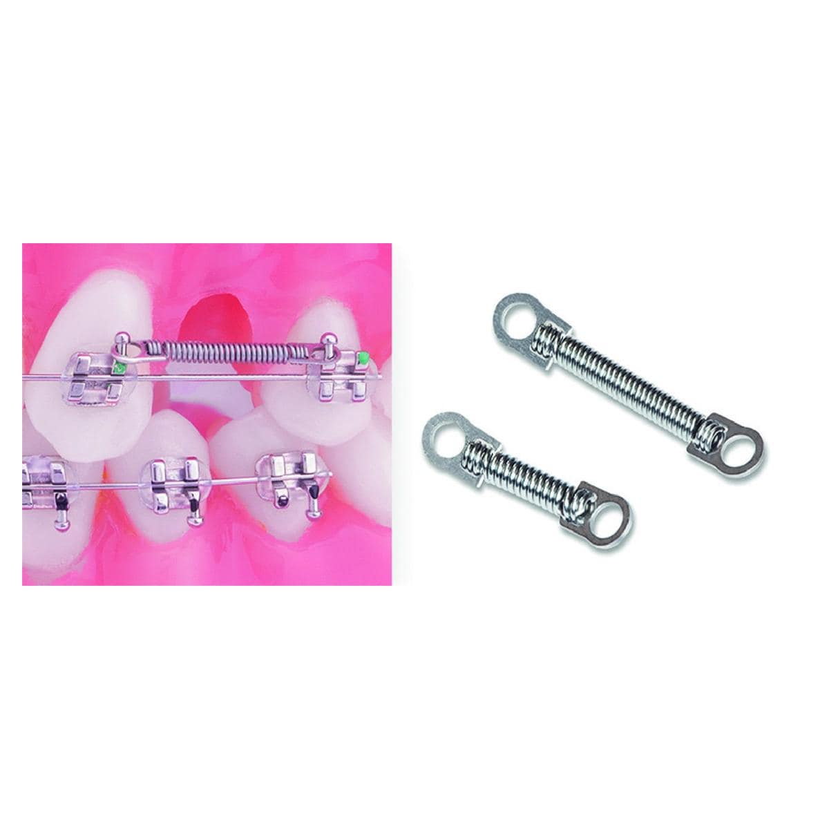 Ressort NiTi ferm avec ailettes TruFlex ORTHO-TECHNOLOGY - Heavy - 12 mm - Bote de 10