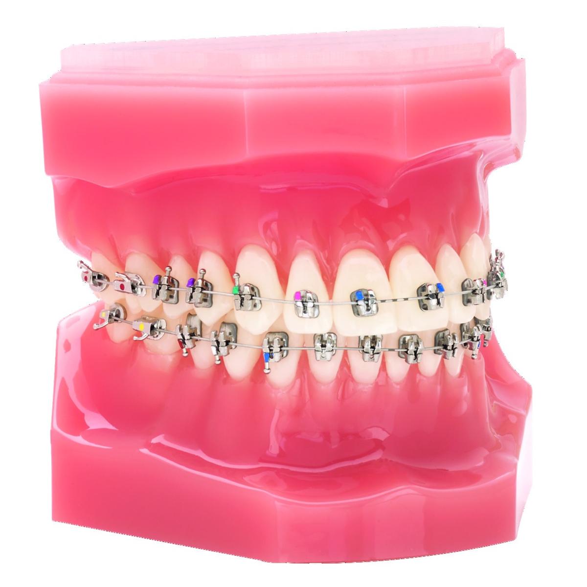 Bracket Lotus Plus DS ORTHOTECHNOLOGY - MBT 0,022 - 5x5 crochet 3/4/5 - Bote de 10