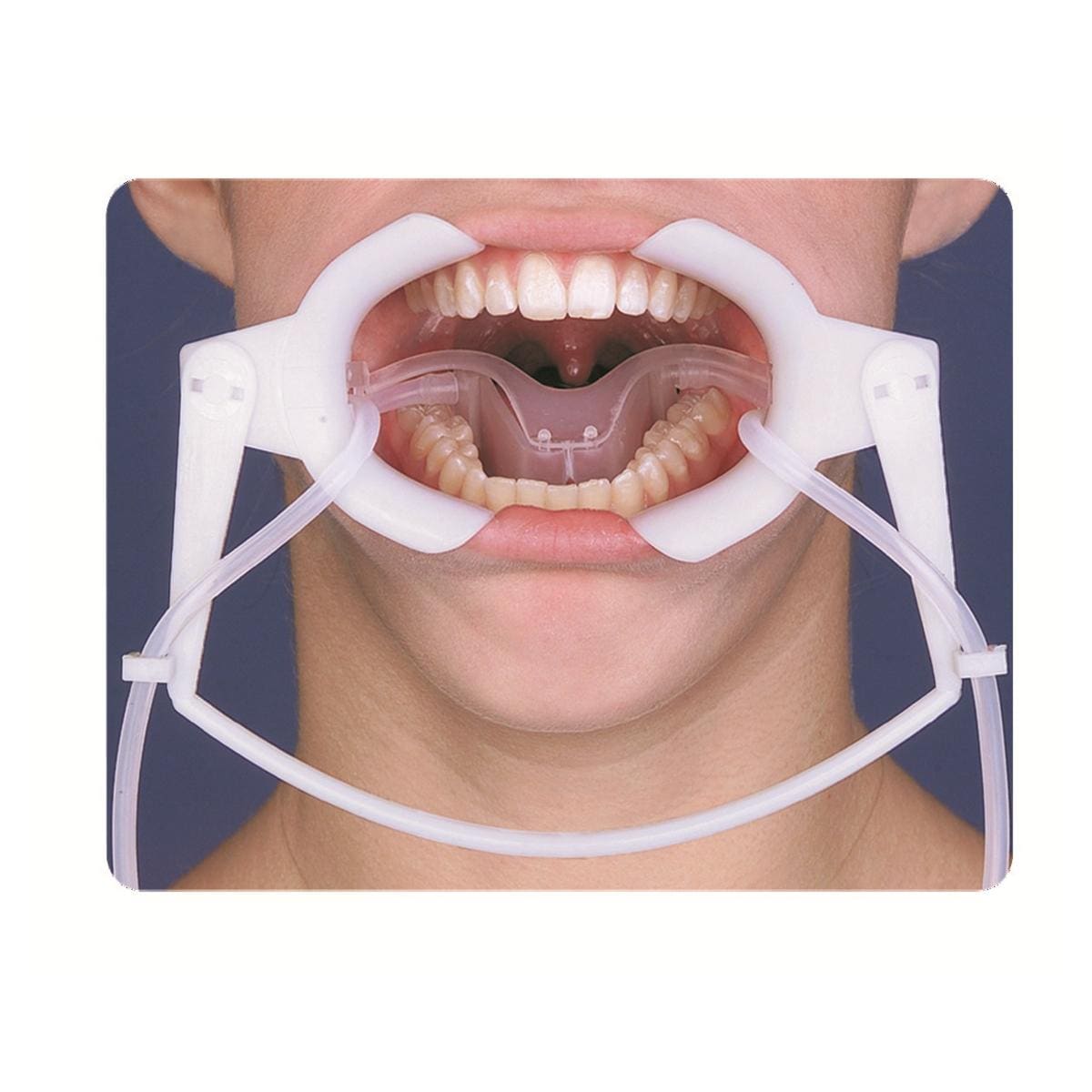 Ecarteur Nola small - 300400 - ORTHO TECHNOLOGY