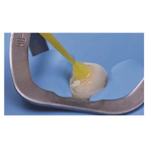Zipbond universal - flacon de 5ml - 8100502 - SDI