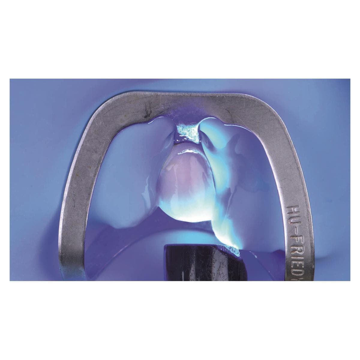 Zipbond universal - flacon de 5ml - 8100502 - SDI