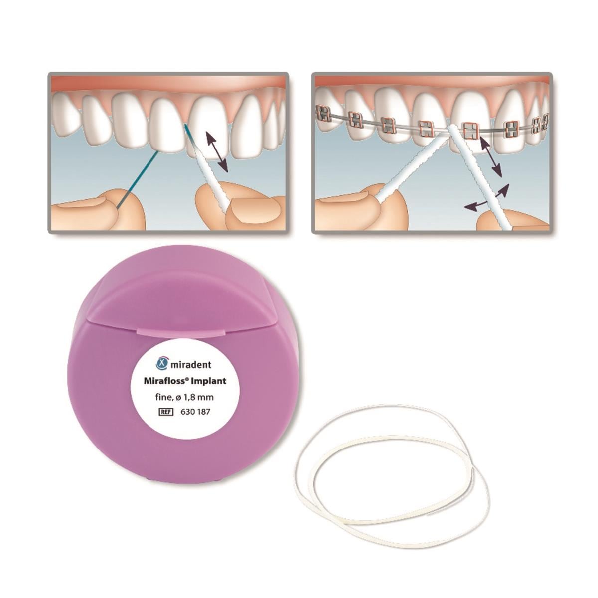 Mirafloss - Fil de soie pour Implant - 1,8MM