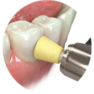 JIFFY ONE CUPULES Grain Moyen (20 units) ULTRADENT