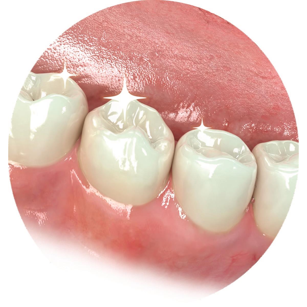JIFFY ONE CUPULES Grain Moyen (20 units) ULTRADENT