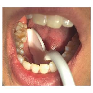 Swe-Flex �jecteur de salive - Boite de 100 - 254150 - Hager & Werken