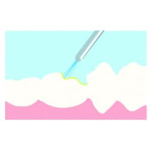 Composite Nano Hybride Natural Elegance - A3/D3 - Unidoses 0,25g - Bote de 20 - HENRY SCHEIN
