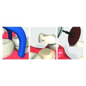 Spot-It DIRECTA - Assortiment de 18