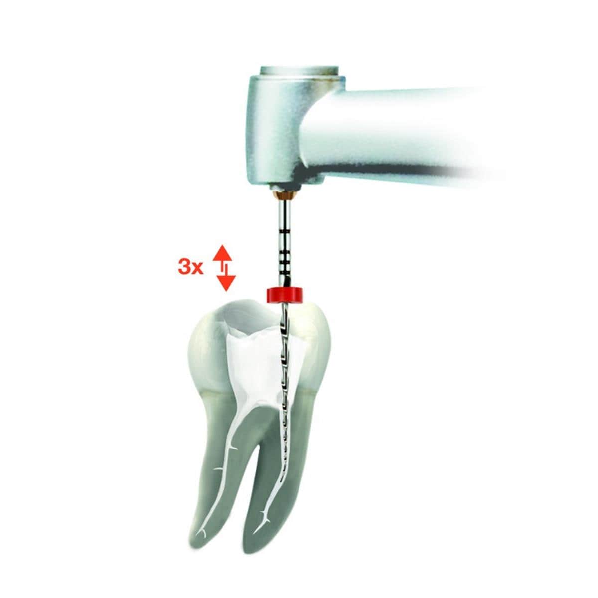 Kit moteur VDW.GOLD reciproc DENTSPLY SIRONA