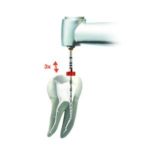 Kit moteur VDW.GOLD reciproc DENTSPLY SIRONA