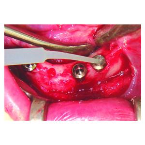 GapSeal HAGER &WERKEN - L'applicateur
