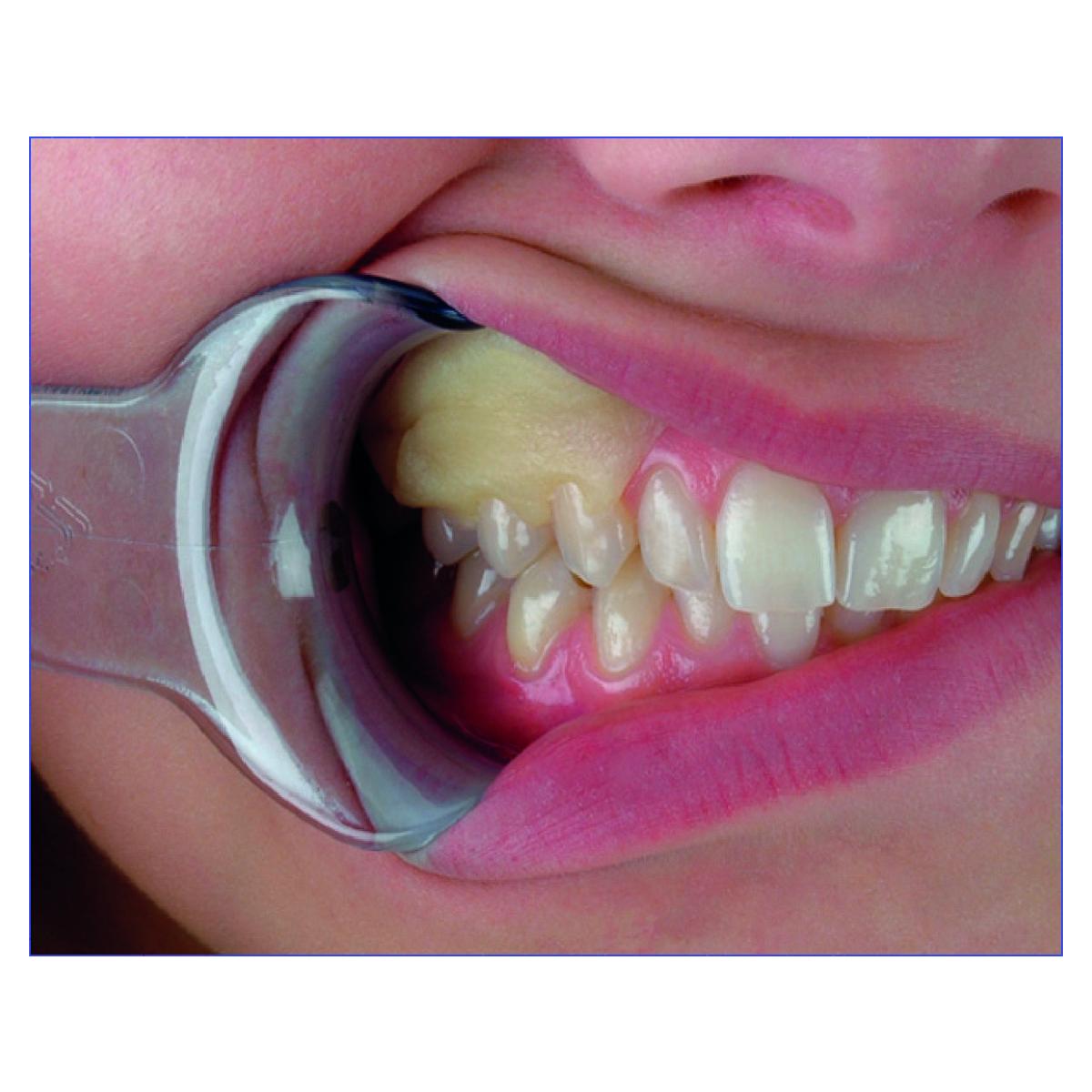 Reso-Pac HAGER & WERKEN - Unidoses de 2g - Bote de 50